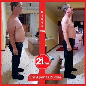antes-depois-antonio-d21